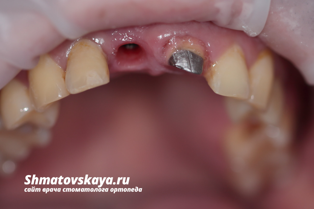 введите описание